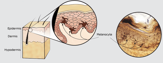Where are melanocyte found - Answers.com